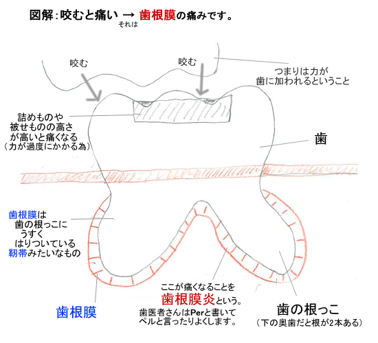 歯根膜の痛み