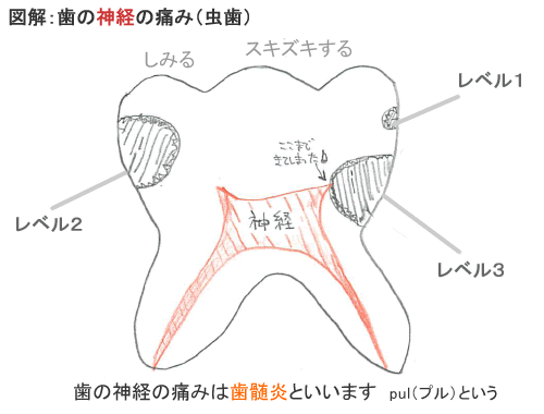 一般歯科 東京都北区 三原歯科医院 公式 赤羽 一般歯科 小児歯科 インプラント Cadcam冠 入れ歯